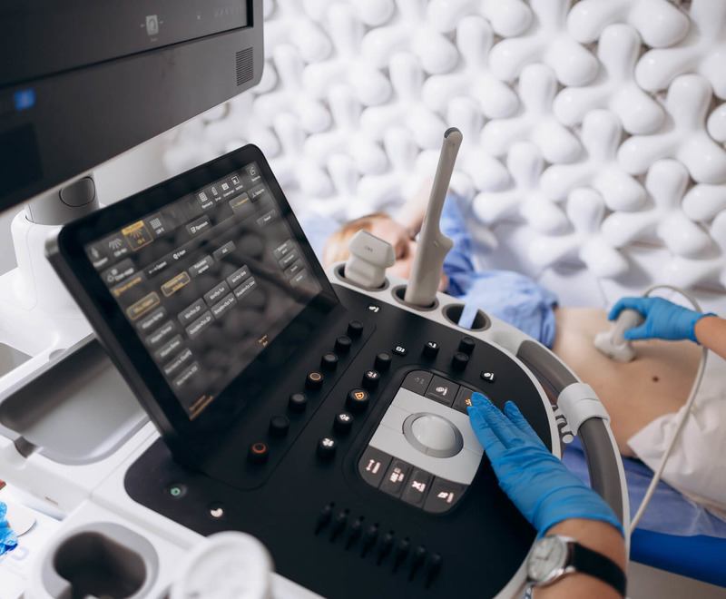 Аденомиоз матки